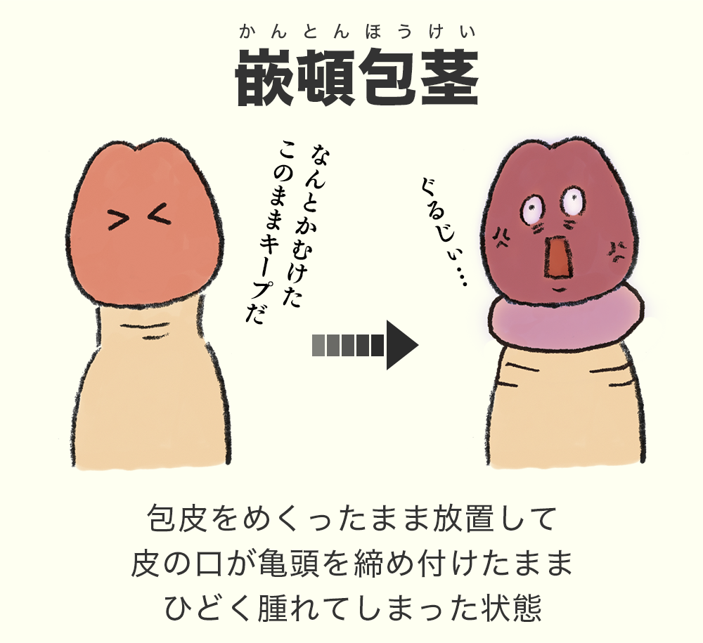 ずる むけ 意味