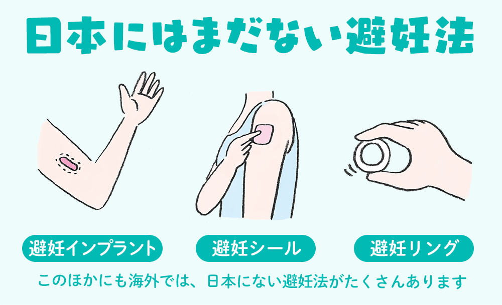 どこにパッチを適用する必要がありますか?